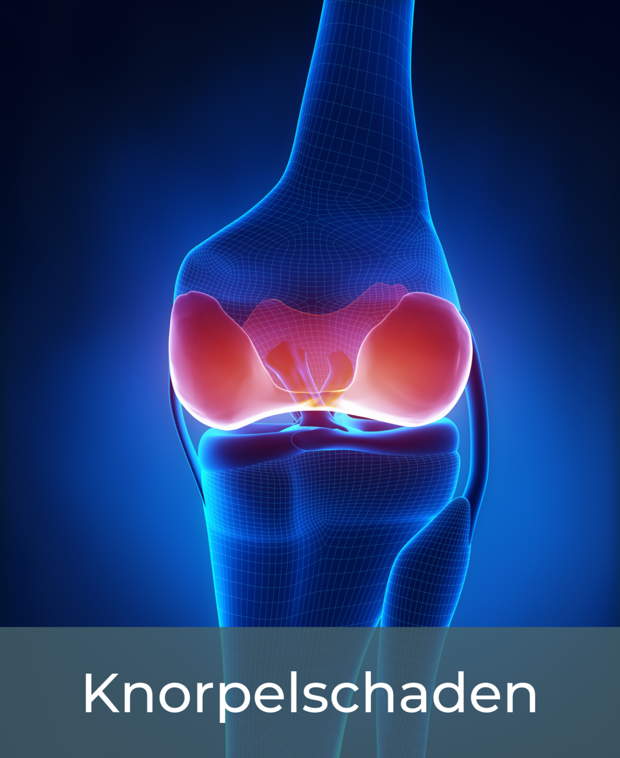 .KNORPELSCHADEN - SPORTYKNEE
